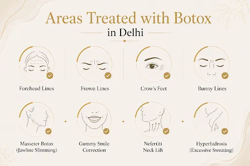 Areas Treated with Botox