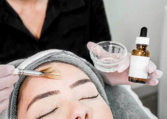chemical peel in Delhi