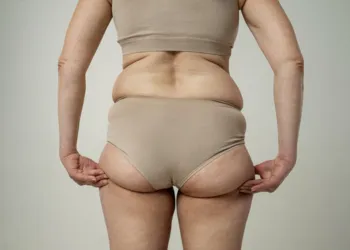 Lower Buttock coolsculpting