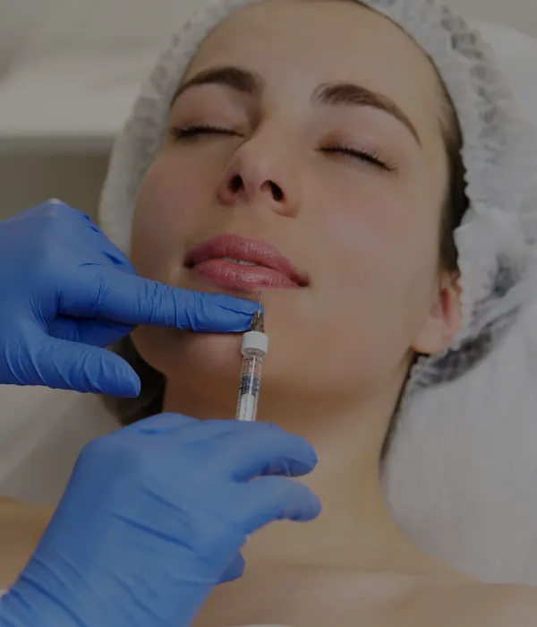 Dermal Fillers