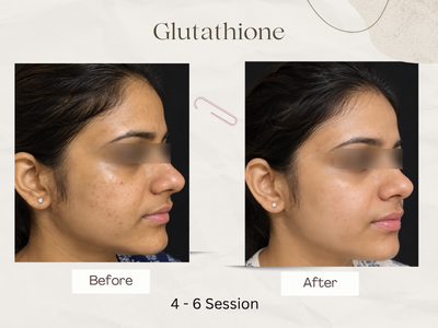 Anti-ageing skin rejuvenation result