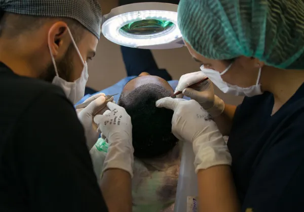 Hair Transplant in Delhi