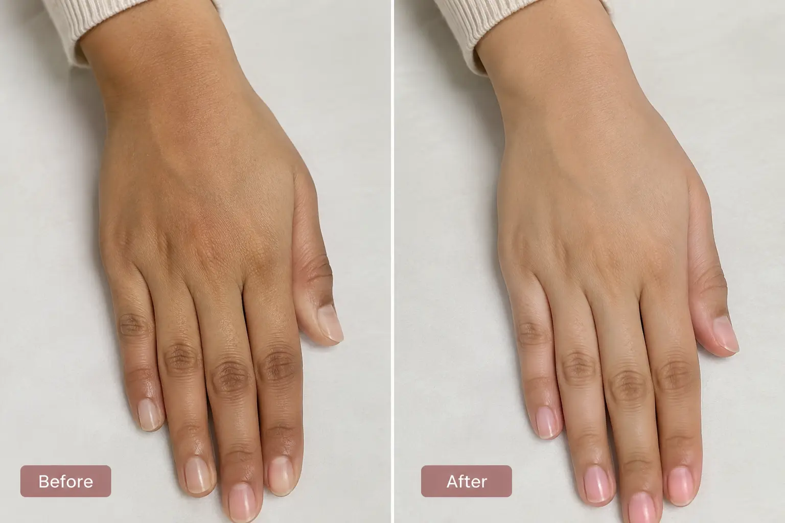 Tan Removal Before After
