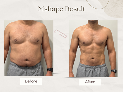 Anti-ageing result Delhi