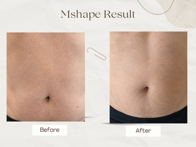 Anti-ageing skin rejuvenation result