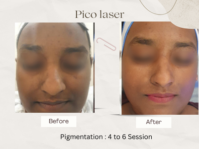 Anti-ageing treatment before after