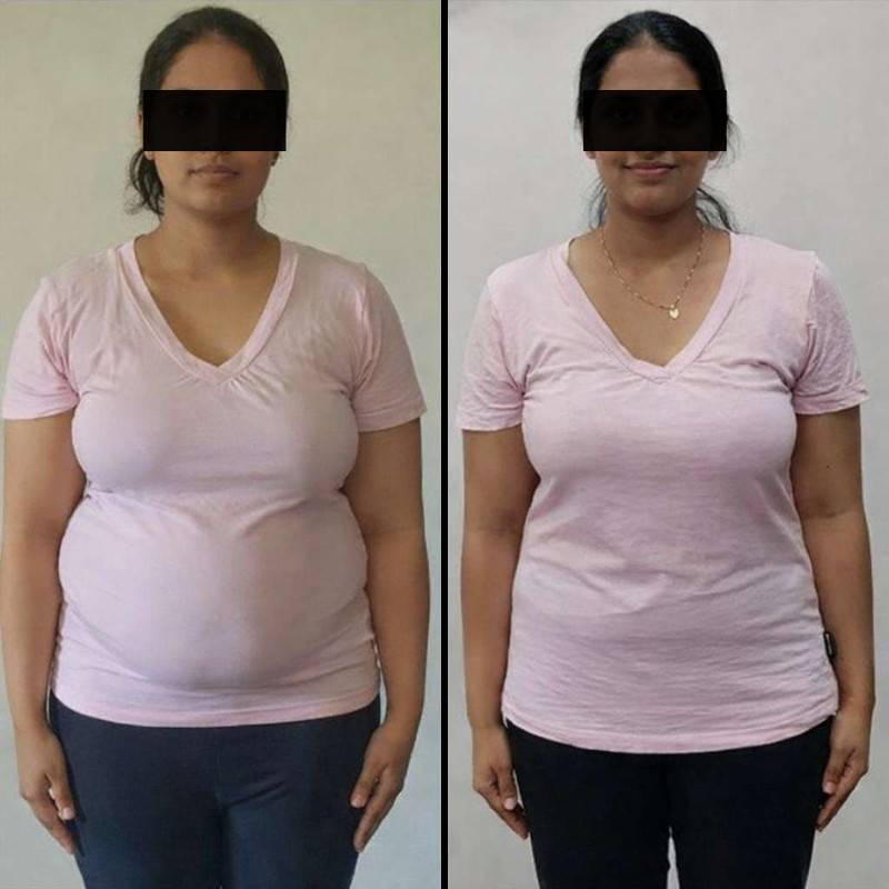 Best weight loss doctor result